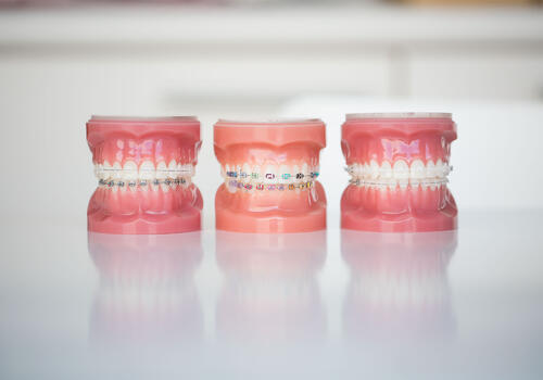 orthodonte Tongeren foto 0